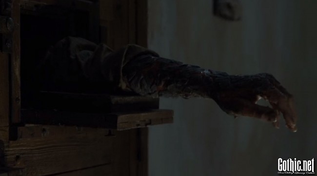deveros arm